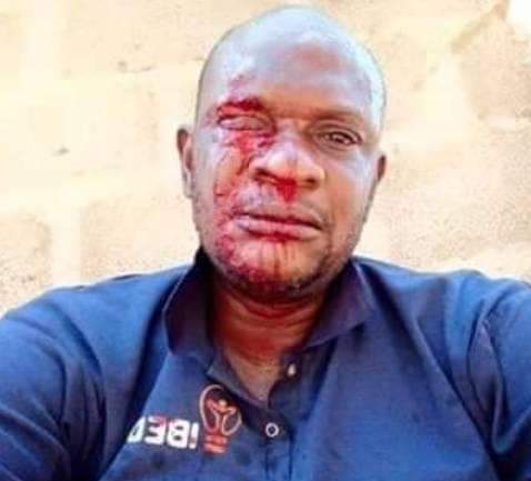 PHCN official attacked while distributing bills in Ogun